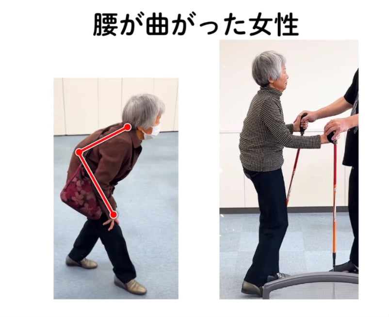 腰が曲がった女性の姿勢改善の様子