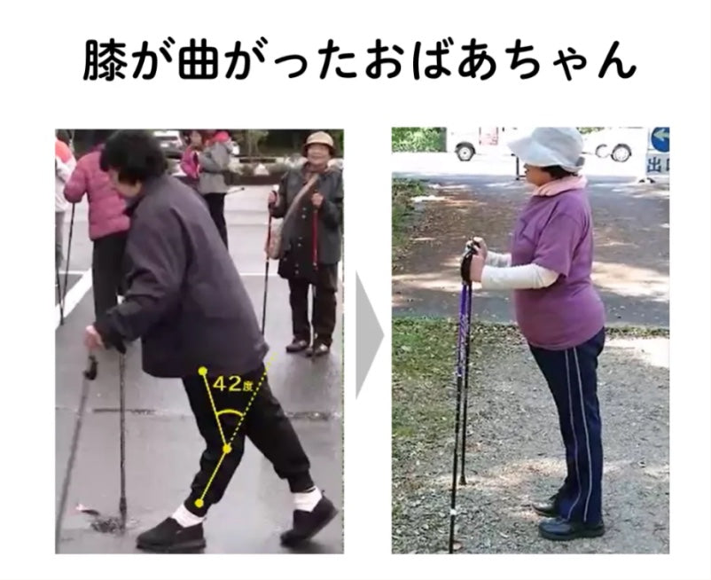 膝が曲がったおばあちゃんの歩行改善の様子